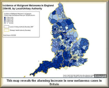 Click Interactive Sun Risk map